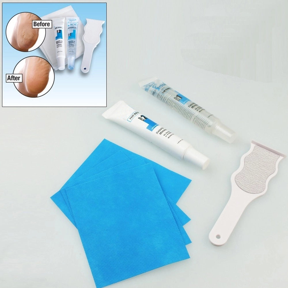 Trade Shop - Kit Pedicure Trattamento Rimuovi Calli Elimina Duroni Dai Piedi In Pochi Minuti -